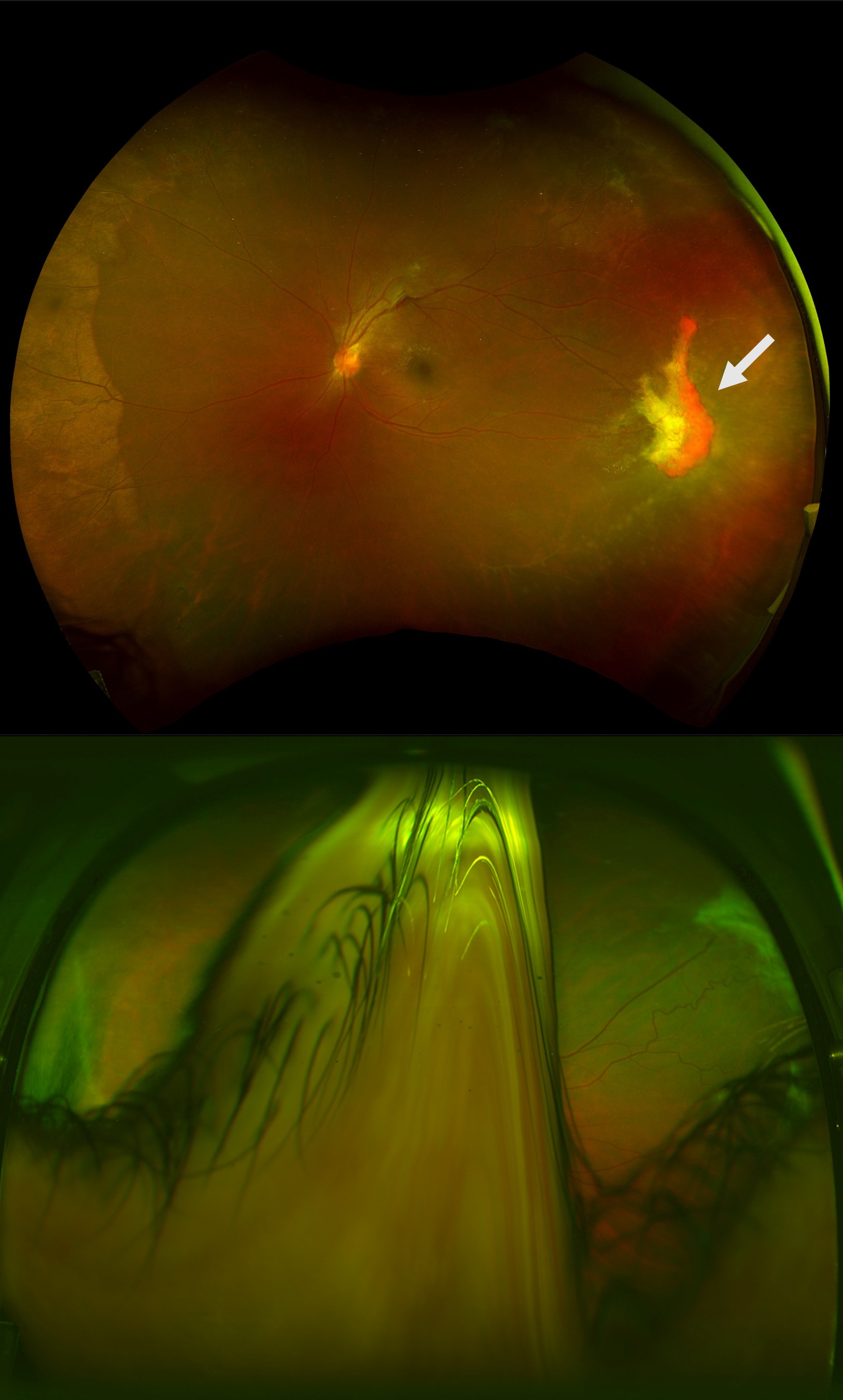 Johns Hopkins researchers receive Retina Society grant - Department of ...