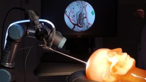 A robot arm with a neuroendoscope positioned in relation to a human head “phantom” for the experimental validation of an augmented neuroendoscopy system.